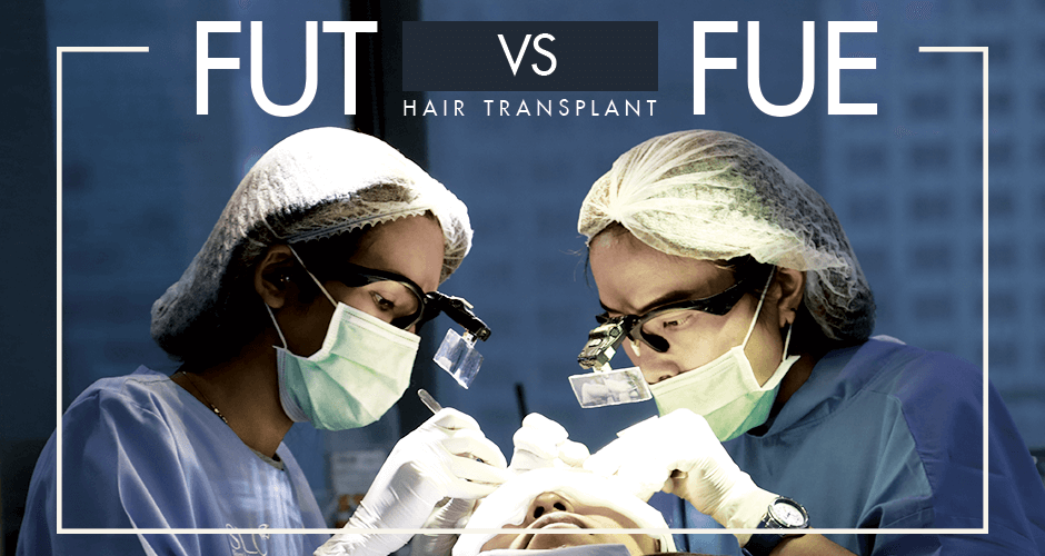 FUT VS FUE (Hair Transplant)