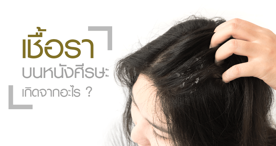 เชื้อราบนหนังศีรษะเกิดจากอะไร?