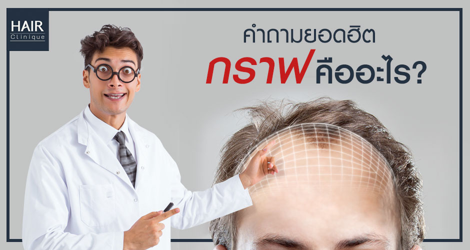 ไขข้อสงสัย! ในการปลูกผม กราฟคืออะไร?