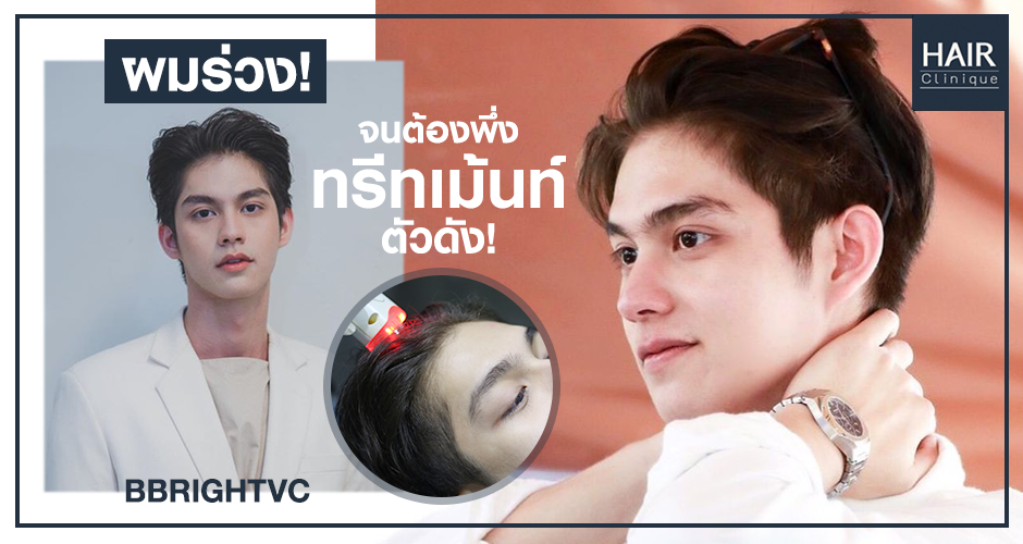 เมื่อหนุ่มสุดฮอตมีปัญหาผมร่วง! ต้องรักษาด้วย Pora Cool Hair และ LED Therapy