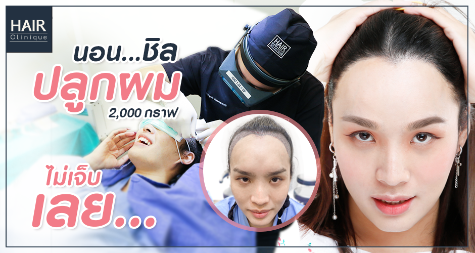 รีวิว ปลูกผม ประสบการณ์ราคาแพง แต่ผลลัพธ์แพงกว่านั้นมาก!