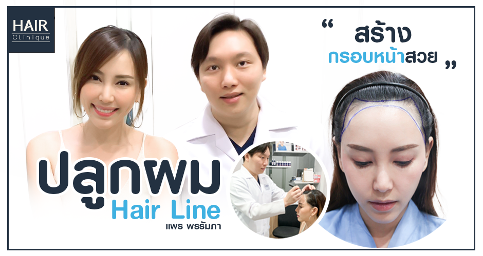 รีวิวปลูกผม Hair Line ให้หน้าเด็ก กรอบหน้าสวย