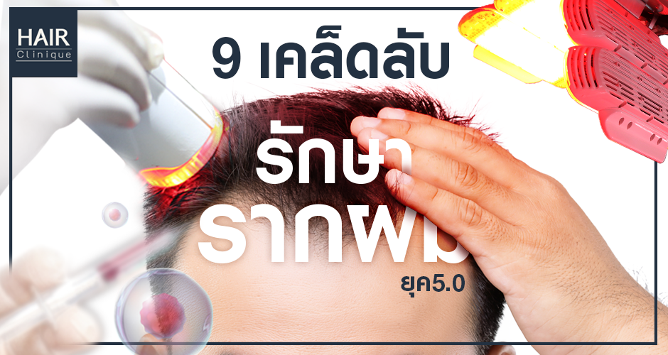 9 เคล็ดลับรักษาผมร่วงยุค 5.0