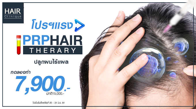 PRP Hair Therapy ปลูกผมไร้แผล ทดลองทำ 7,900.- (ปกติ 9,900.-)