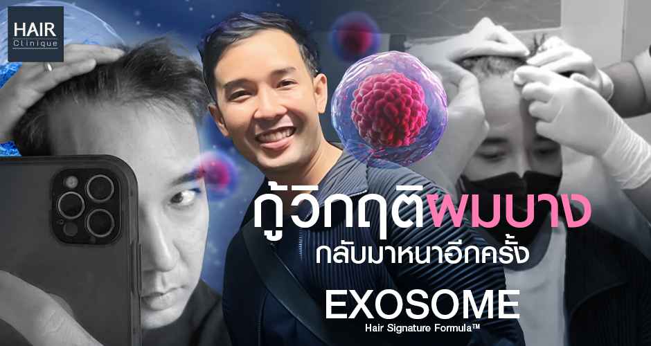 กู้วิกฤติผมบาง กลับมาหนาอีกครั้ง Exosome Hair Signature Formula™