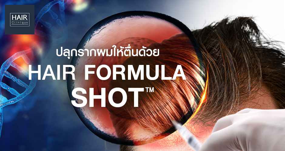 ลดผมร่วง เพิ่มผมหนา ปลุกรากผมให้ตื่นด้วย Hair formula shot™ ปลูกผมแบบไม่ผ่าตัด ผมหนาดกดำแข็งแรง