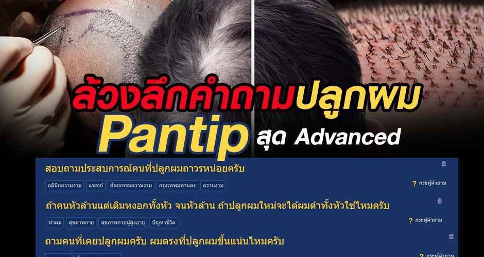 ล้วงลึกคำถามปลูกผม Pantip สุด Advanced