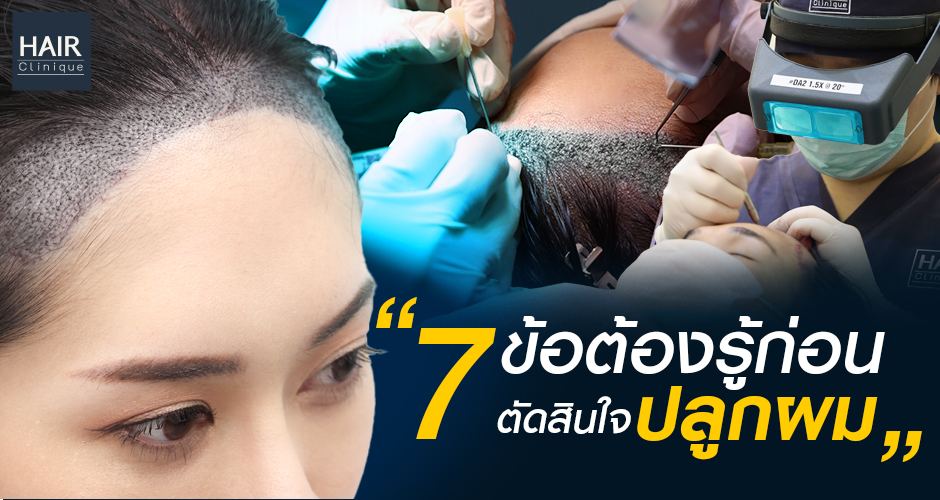 7 ข้อต้องรู้ก่อนตัดสินใจปลูกผม