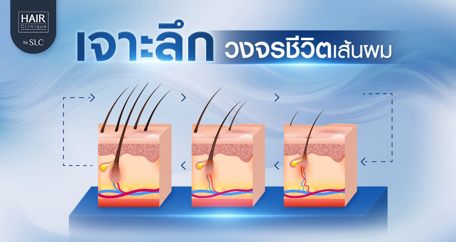 เจาะลึกวงจรชีวิตเส้นผมตั้งแต่เกิดจนหลุดร่วง จากรากผมถึงปลายผม