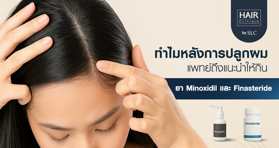 ทำไมหลังการปลูกผม แพทย์ถึงแนะนำให้กินยา Minoxidil และ Finasteride