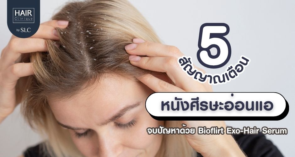 5 สัญญาณเตือนหนังศีรษะอ่อนแอ จบปัญหาด้วย Bioflirt Exo-Hair Serum