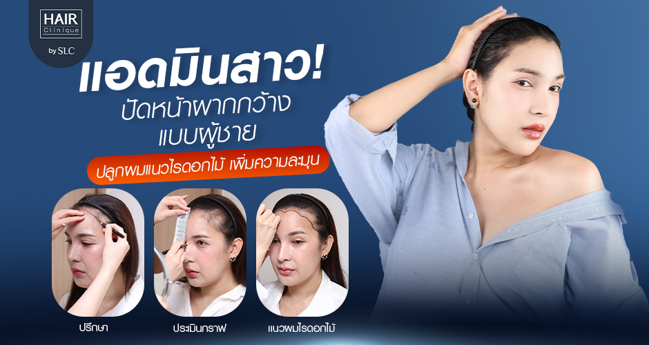 แอดมินสาว! ปัดหน้าผากกว้างแบบผู้ชาย ปลูกผมแนวไรดอกไม้ เพิ่มความละมุนแบบพสจีน