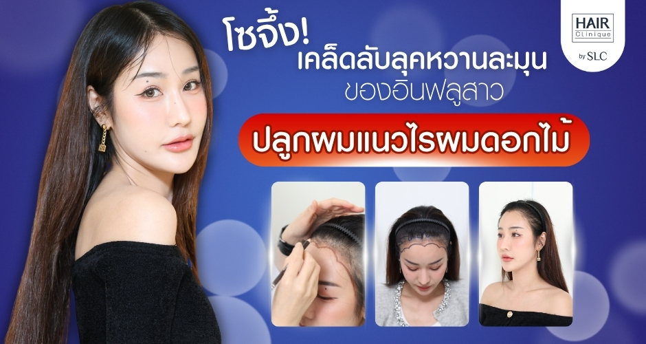 โซจึ้ง! ปลูกผมแนวไรผมดอกไม้ เคล็ดลับลุคหวานละมุนของอินฟลูสาว