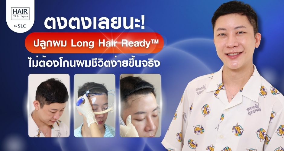 ตงตงเลยนะ! ปลูกผม Long Hair Ready™ ไม่ต้องโกนผมชีวิตง่ายขึ้นจริง