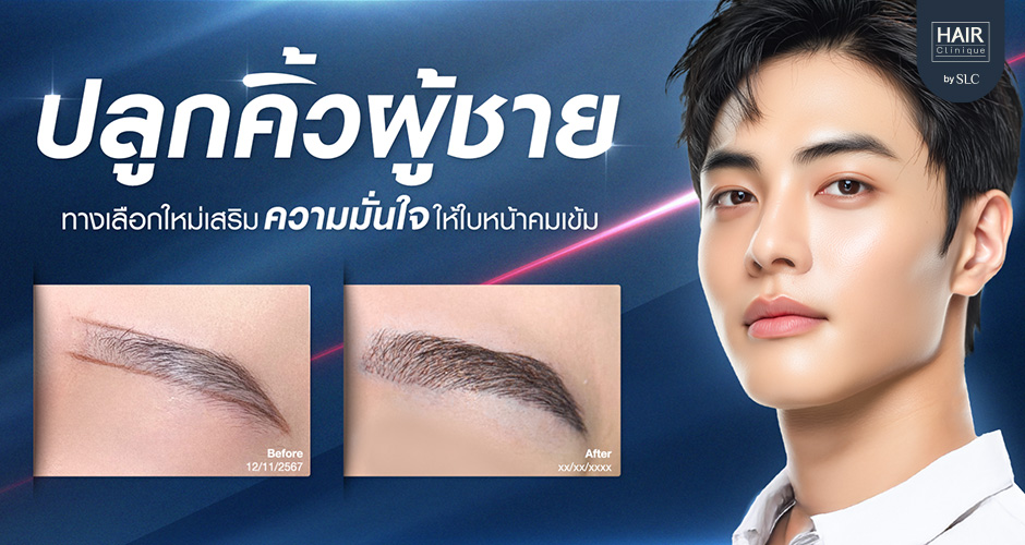 ปลูกคิ้วผู้ชาย ทางเลือกใหม่เสริมความมั่นใจให้ใบหน้าคมเข้ม