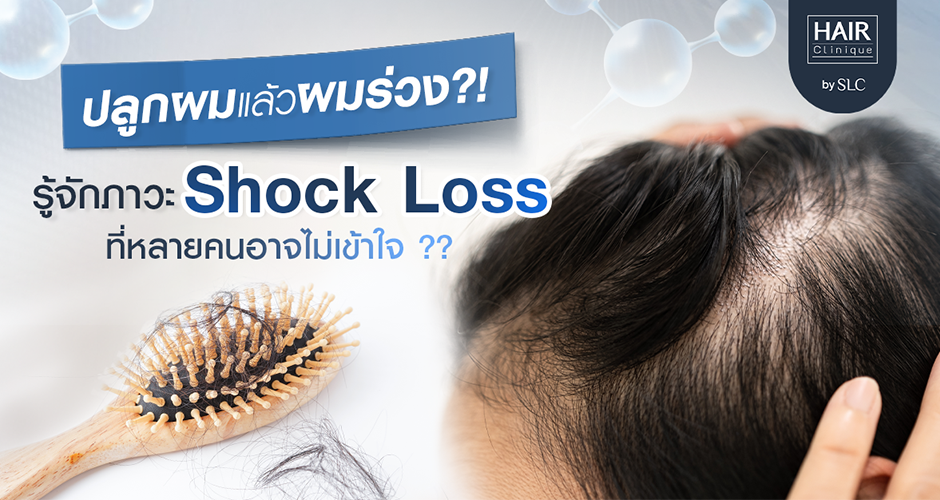 ปลูกผม แล้วผมร่วง! รู้จักภาวะ Shock Loss ที่หลายคนอาจไม่เข้าใจ