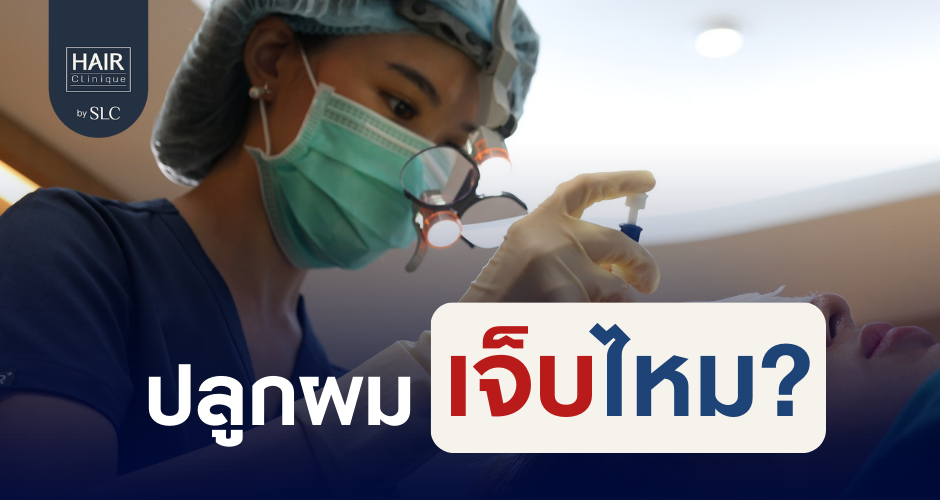 ปลูกผมเจ็บไหม? มาหาคำตอบที่ทำให้คุณหายกังวล!