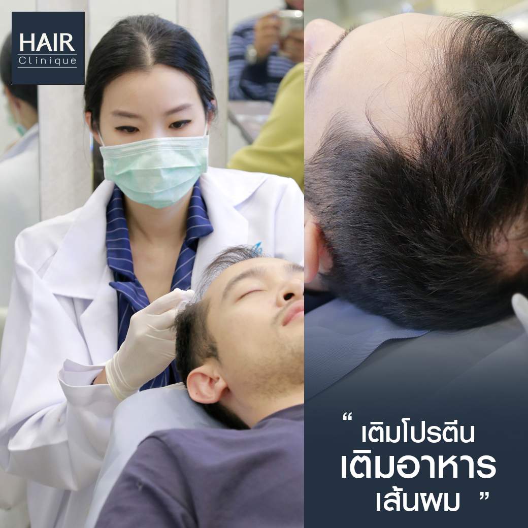 วิตามิน แก้ ผม ร่วง pantip,ผมร่วง,Hair fomula shot,วิธี หยุดผมร่วง,Hair formula shot™,Hair formula shot,ExosomeHair,หยุดผมร่วง,วิธีหยุดผมร่วง