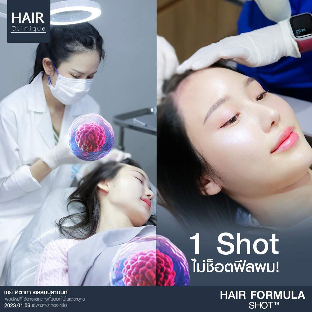 วิตามิน แก้ ผม ร่วง pantip,ผมร่วง,Hair fomula shot,วิธี หยุดผมร่วง,Hair formula shot™,Hair formula shot,ExosomeHair,หยุดผมร่วง,วิธีหยุดผมร่วง