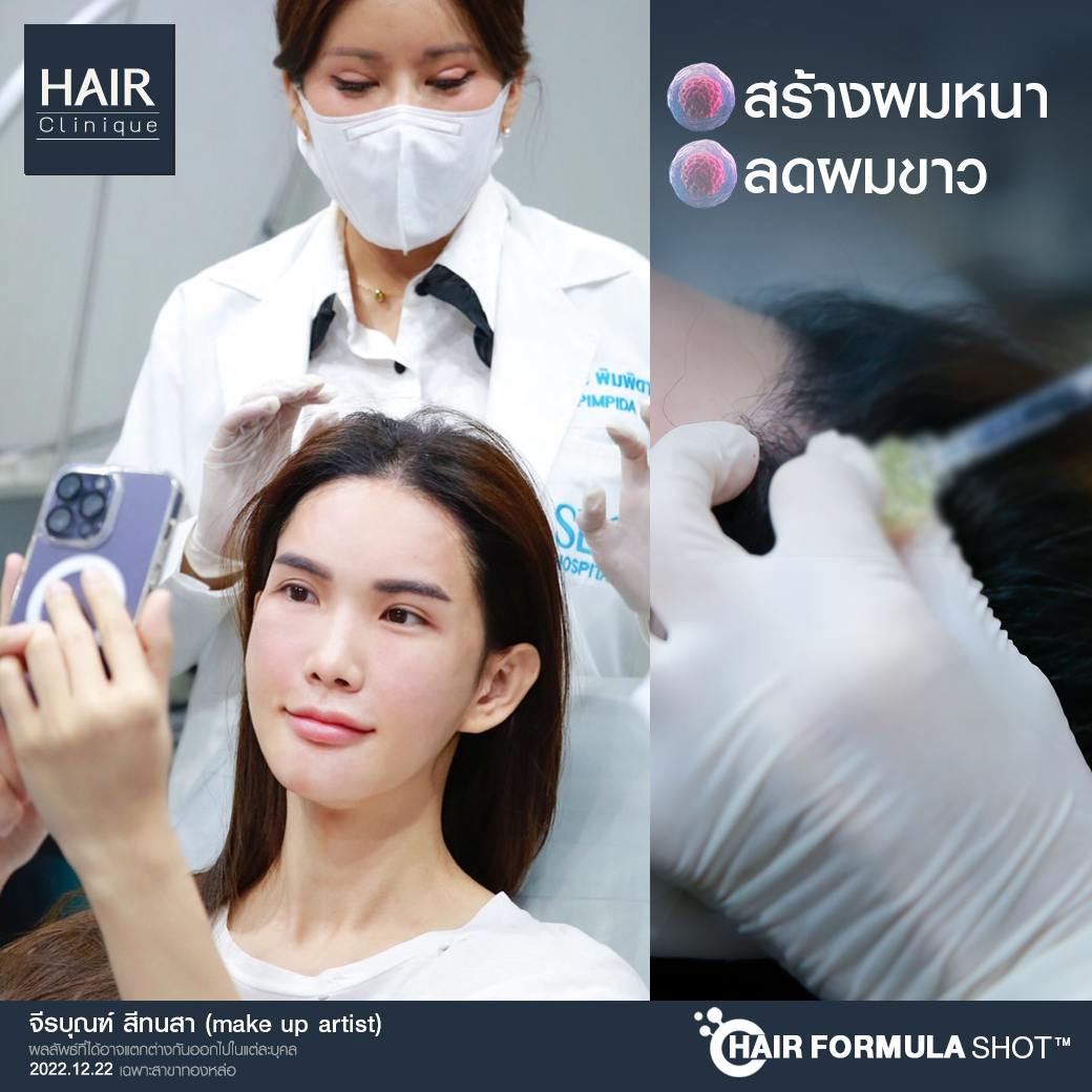 วิตามิน แก้ ผม ร่วง pantip,ผมร่วง,Hair fomula shot,วิธี หยุดผมร่วง,Hair formula shot™,Hair formula shot,ExosomeHair,หยุดผมร่วง,วิธีหยุดผมร่วง