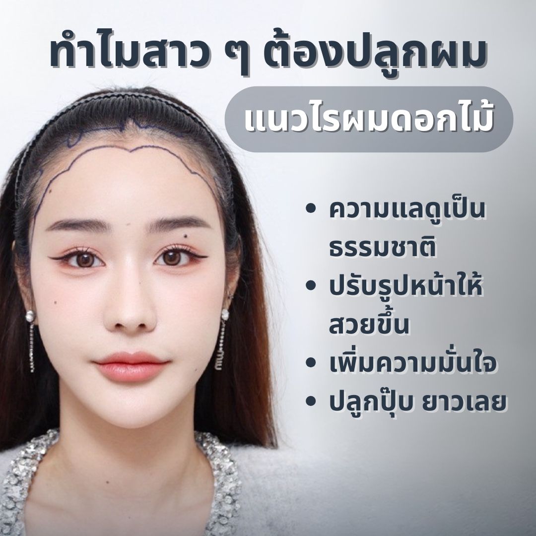แนวไรผมดอกไม้
