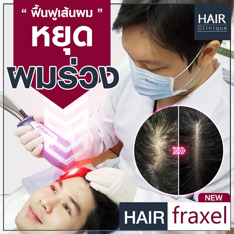 HairFraxel-ฟื้นฟูรากผม-ลดผมร่วง