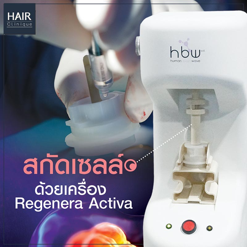 HairStemCell-ปลูกผมไม่ต้องผ่าตัด-ลดผมร่วง