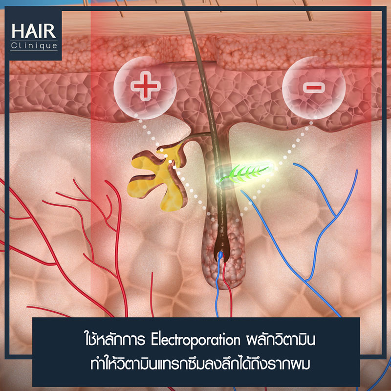 ทรีทเม้นต์ลดผมร่วง-แก้ปัญหาผมร่วง-ลดผมร่วง