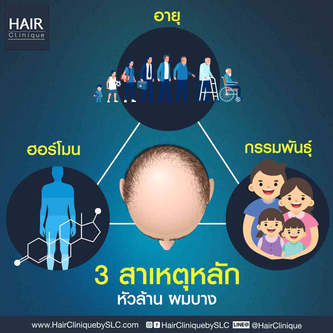 3สาเหตุหลักผมร่วงผมบางหัวล้าน