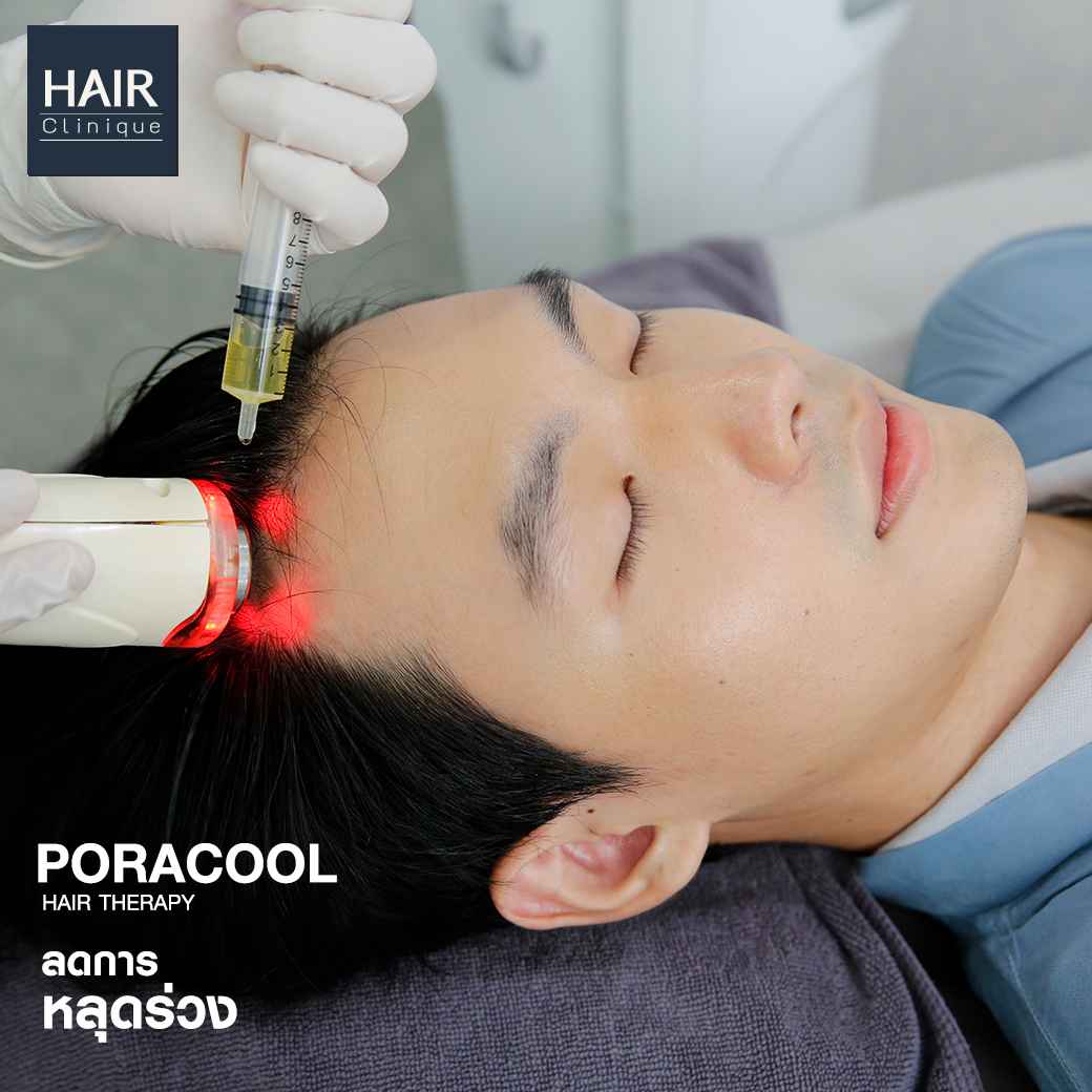 poracoolhair,ปลูกผม,ปลูกผมที่ไหนดี,ปลูกผม hairclinique,รีวิวปลูกผม,ปลูกผมถาวร,รีวิวปลูกผม hairclinique