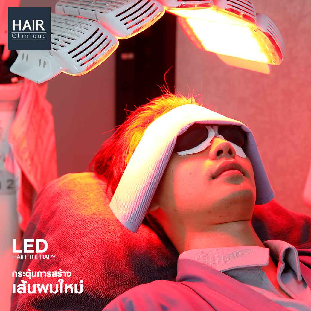 ledtherapy,ปลูกผม,ปลูกผมที่ไหนดี,ปลูกผม hairclinique,รีวิวปลูกผม,ปลูกผมถาวร,รีวิวปลูกผม hairclinique