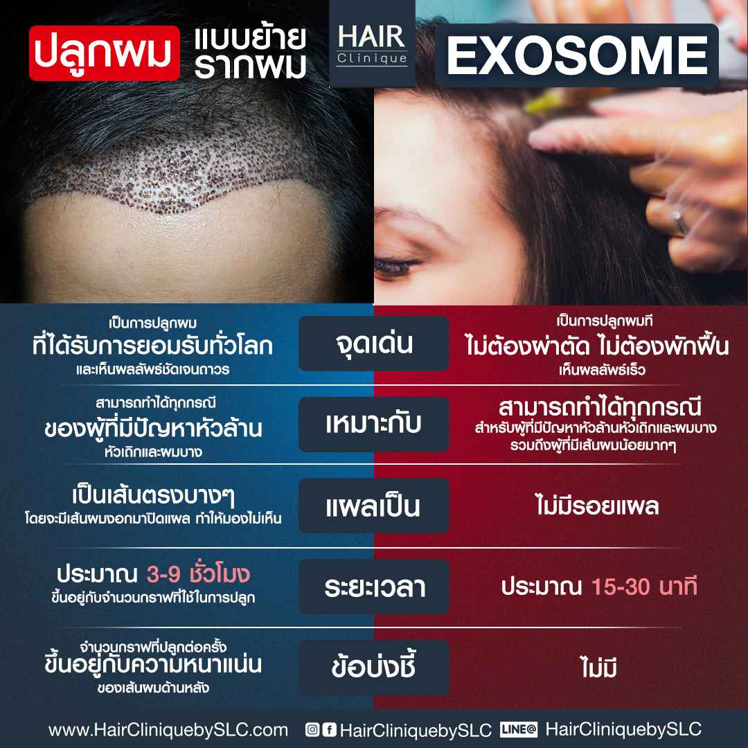 ปลูกผมแบบย้ายรากผม,ปลูกผมfut,ปลูกผมfue,ปลูกผม,รีวิวปลูกผม,ปลูกผม hairclinique