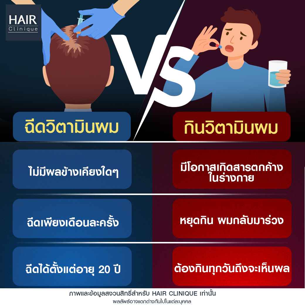 วิตามินบำรุงผม,วิตามินบํารุงผม ยี่ห้อไหนดี,วิตามินบํารุงผม รีวิว,วิตามินบำรุงผมร่วง,ExosomeSLC,ฉีดวิตามินExosome,ฉีด Exosome SLC,รีวิว Exosome SLC,Exosome Signature Formula™