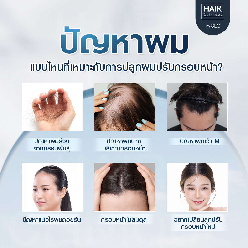 ปลูกผมปรับกรอบหน้า, ปลูกผม, ปลูกผม Long Hair Ready™, ปลูกคิ้ว Eyebrow Art FUE™