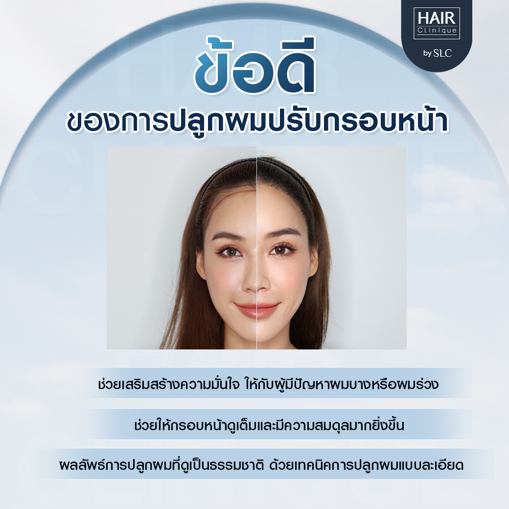 ปลูกผมปรับกรอบหน้า, ปลูกผม, ปลูกผม Long Hair Ready™, ปลูกคิ้ว Eyebrow Art FUE™