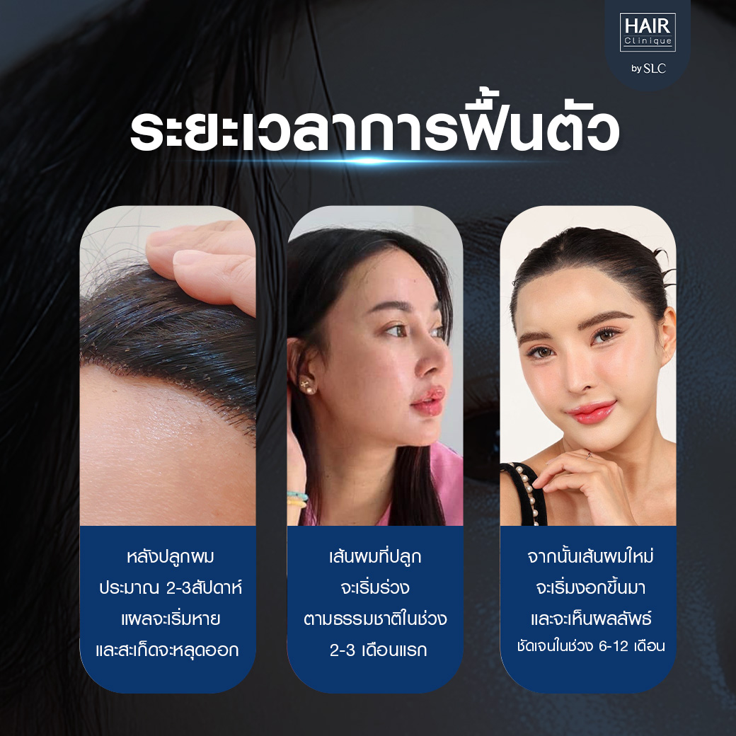 ปลูกผมปรับกรอบหน้า, ปลูกผม, ปลูกผม Long Hair Ready™, ปลูกคิ้ว Eyebrow Art FUE™