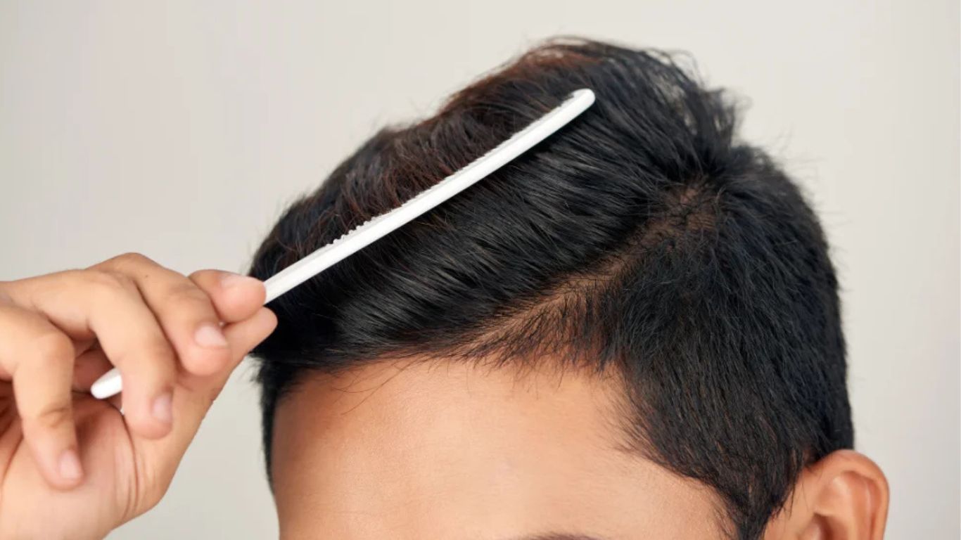 ปลูกผมเพิ่มความมั่นใจ เห็นผลลัพธ์ทันทีได้ที่ Hair Clinique by SLC