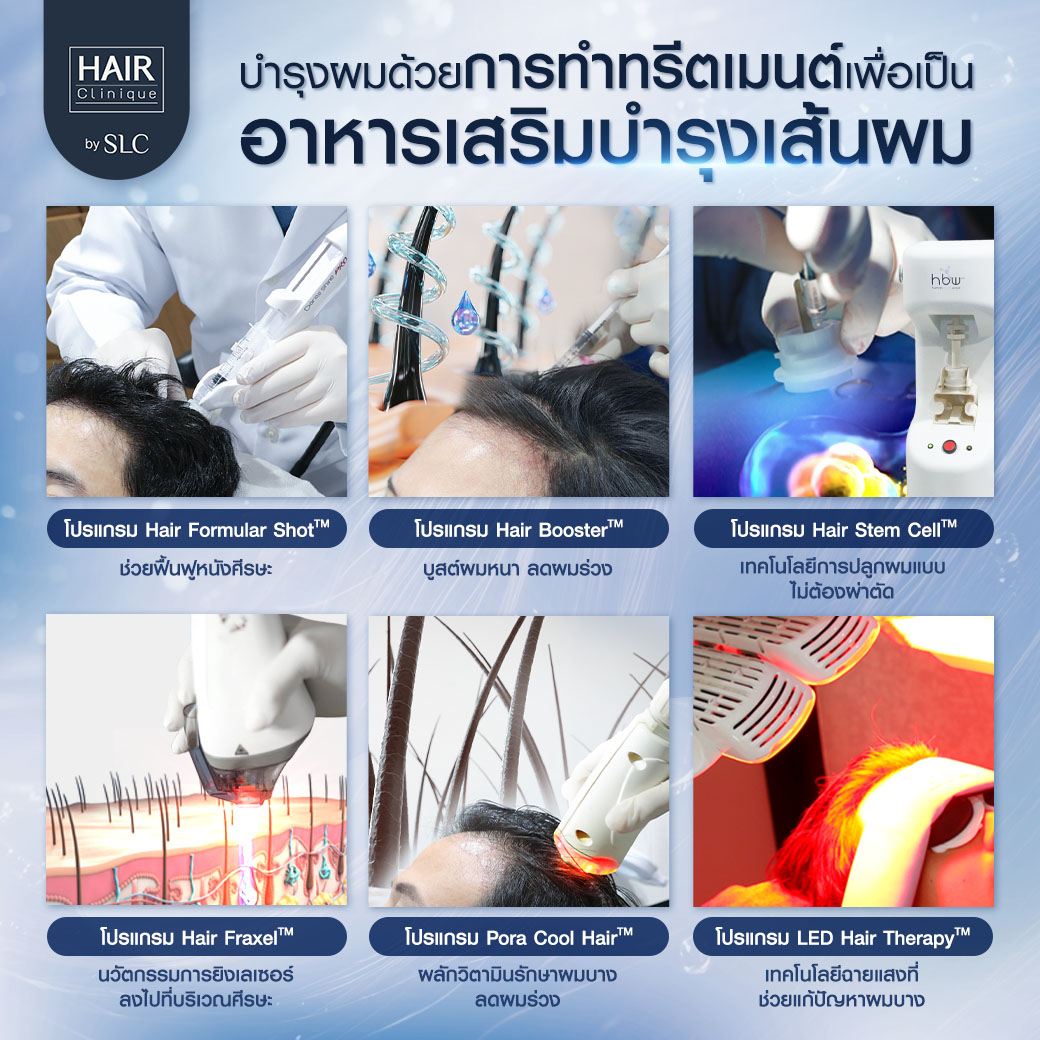 วงจรเส้นผม, ปลูกผม, ปลูกคิ้ว, รากผม, ผมร่วง, ผมบาง