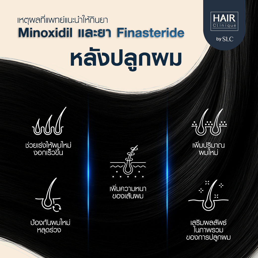 ยา Minoxidil, ปลูกผม, ยา Finasteride, หลังการปลูกผม, ผมร่วง, ผมบาง