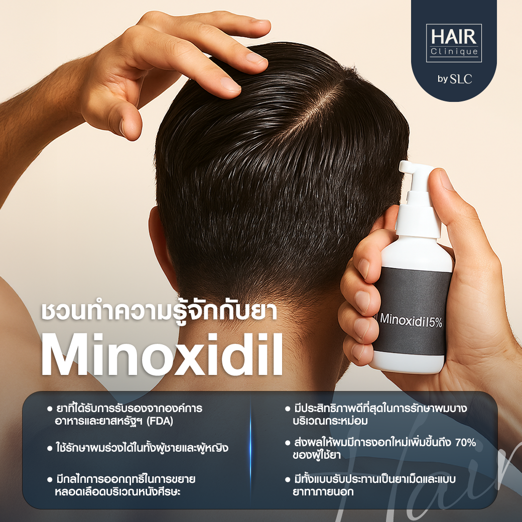 ยา Minoxidil, ปลูกผม, ยา Finasteride, หลังการปลูกผม, ผมร่วง, ผมบาง