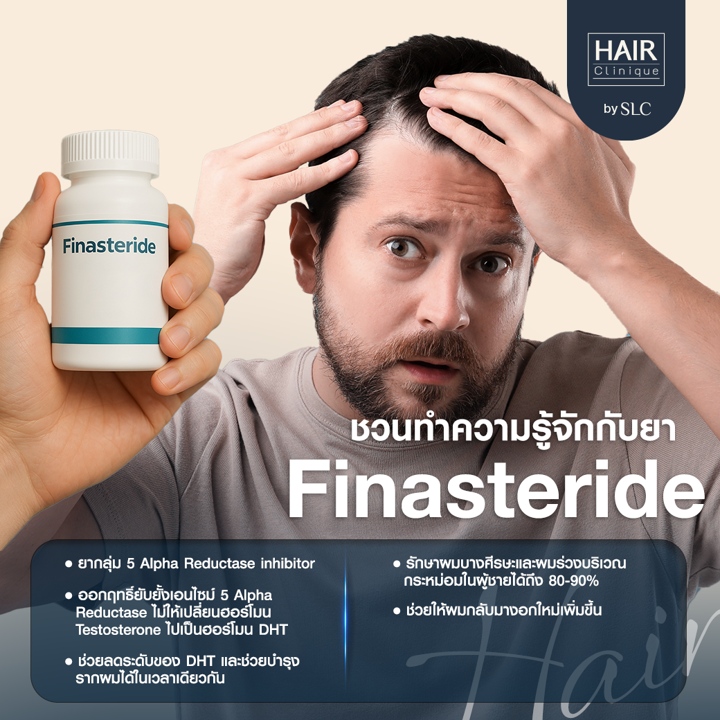 ยา Minoxidil, ปลูกผม, ยา Finasteride, หลังการปลูกผม, ผมร่วง, ผมบาง