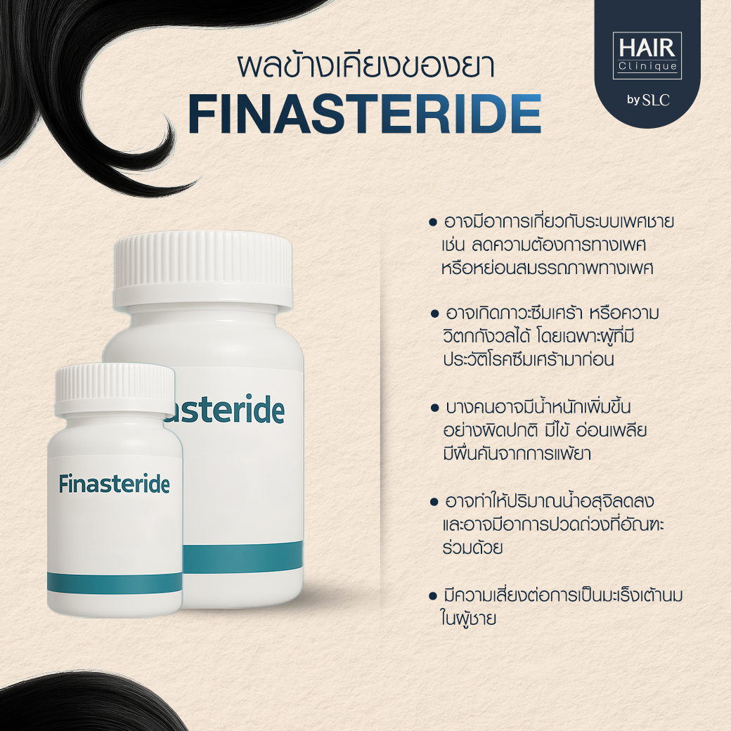 ยา Minoxidil, ปลูกผม, ยา Finasteride, หลังการปลูกผม, ผมร่วง, ผมบาง