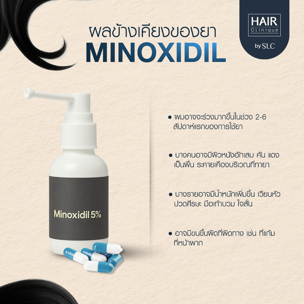 ยา Minoxidil, ปลูกผม, ยา Finasteride, หลังการปลูกผม, ผมร่วง, ผมบาง