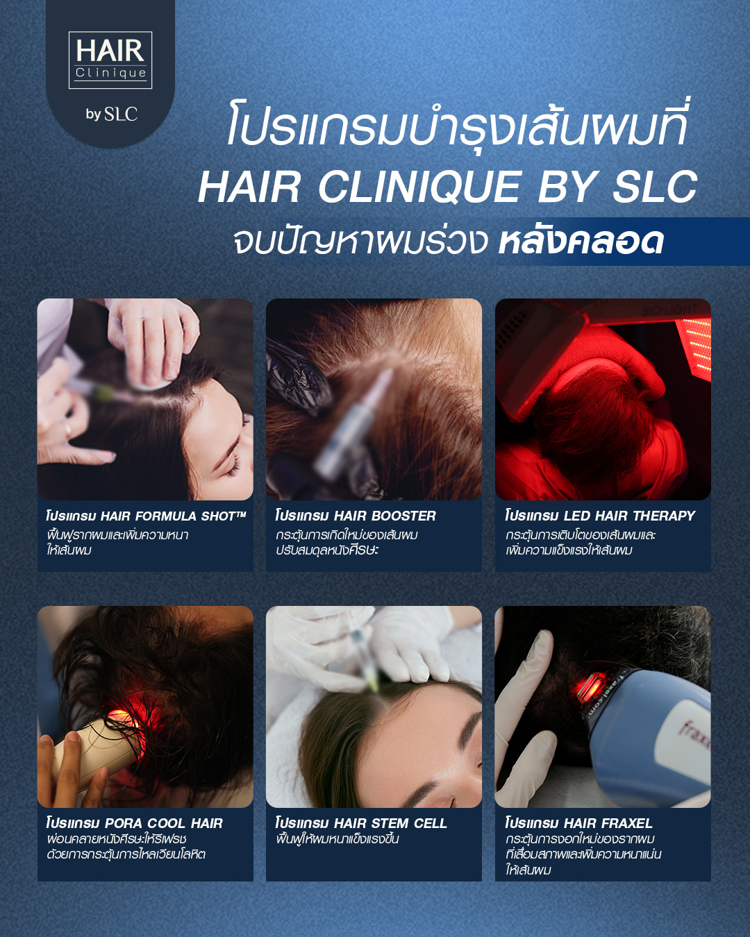 ผมร่วงหลังคลอด, ผมร่วง, ฮอร์โมน, เส้นผม, แม่ตั้งครรภ์ผมร่วง, แม่มือใหม่, ปัญหาผมคุณแม่หลังคลอด