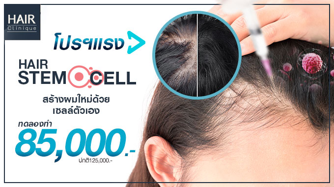 โปรโมชั่นปลูกผม Stem Cell 