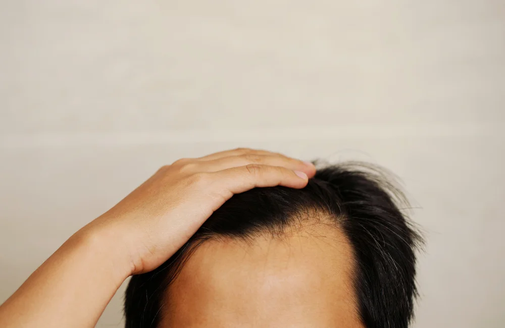 หัวเถิกเกิดจากอะไร