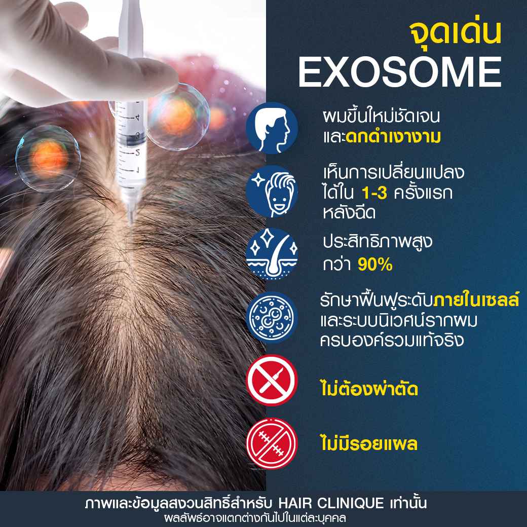 จุดเด่นExosome-ฉีดExosome-ปลูกผมไม่ผ่าตัด-ฉีดยาปลูกผม-ExosomeSLC-