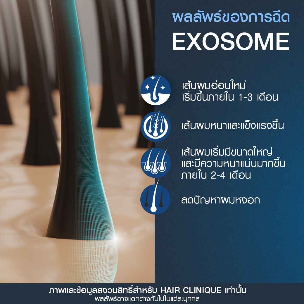 ผลลัพธ์Exosome-ฉีดExosome-ปลูกผมไม่ผ่าตัด-ฉีดยาปลูกผม-ExosomeSLC-