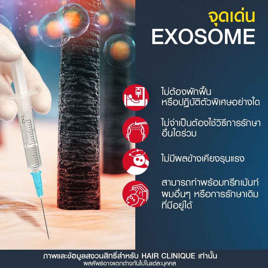 ข้อดีExosome,แก้ปัญหาผมร่วง,ผมบาง,ผมร่วง,ฉีดผม Exosome,เอ็กโซโซม