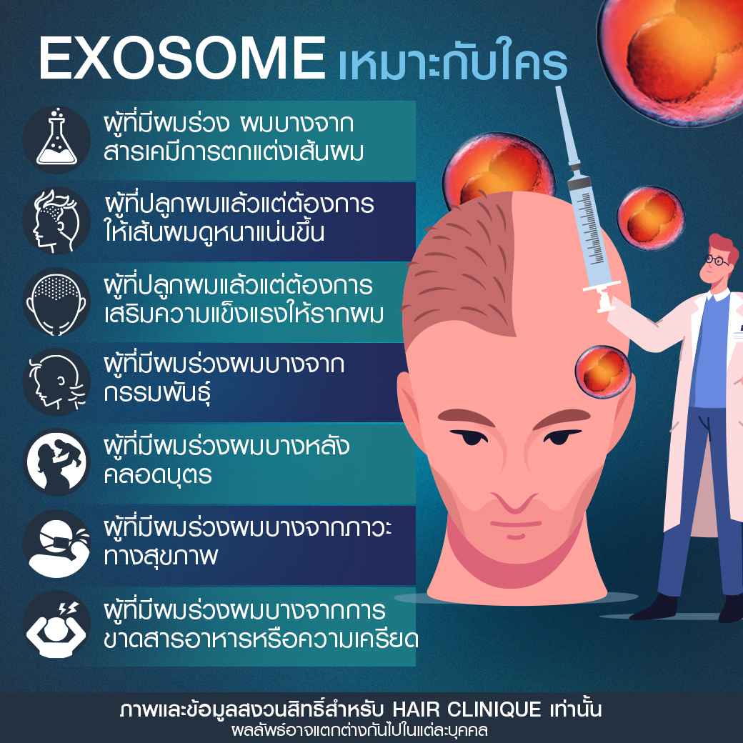 Exosomeเหมาะกับใคร-ฉีดExosome-ปลูกผมไม่ผ่าตัด-ฉีดยาปลูกผม-ExosomeSLC-